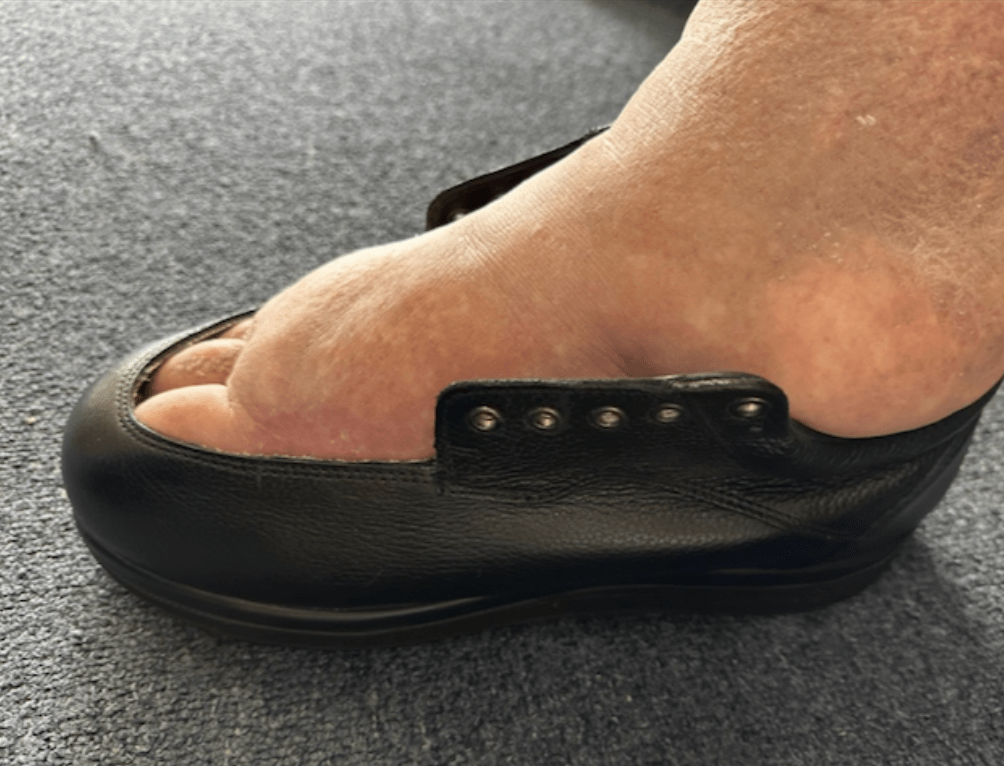 Wide fit shoes for swollen feet with adjustable closure and supportive medical grade footwear